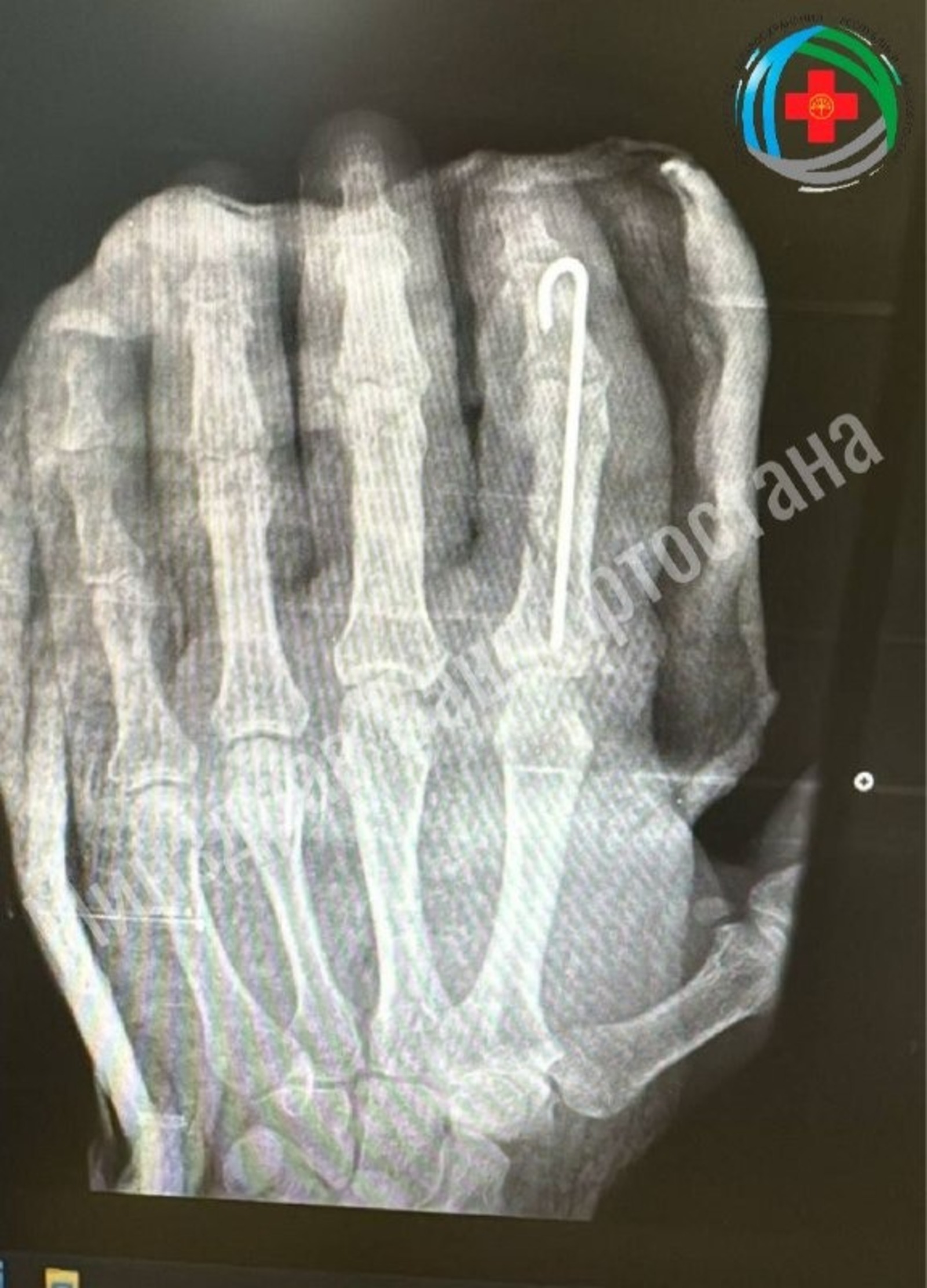 Пуртăпа касса татнă пÿрнине çĕлесе сыпăнтарнă