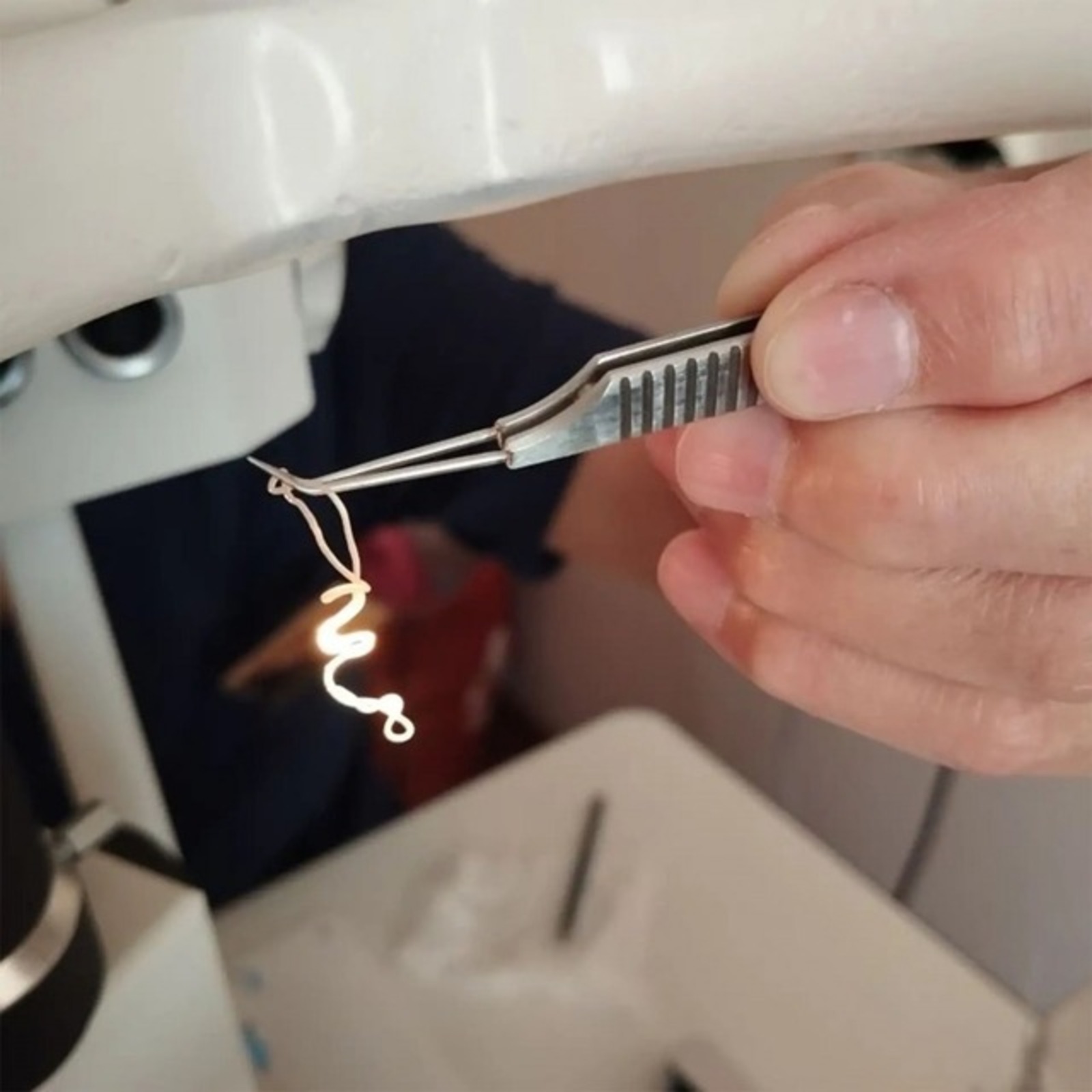 Арҫын куҫӗнчен 20 см тӑршшӗ хурт кӑларнӑ