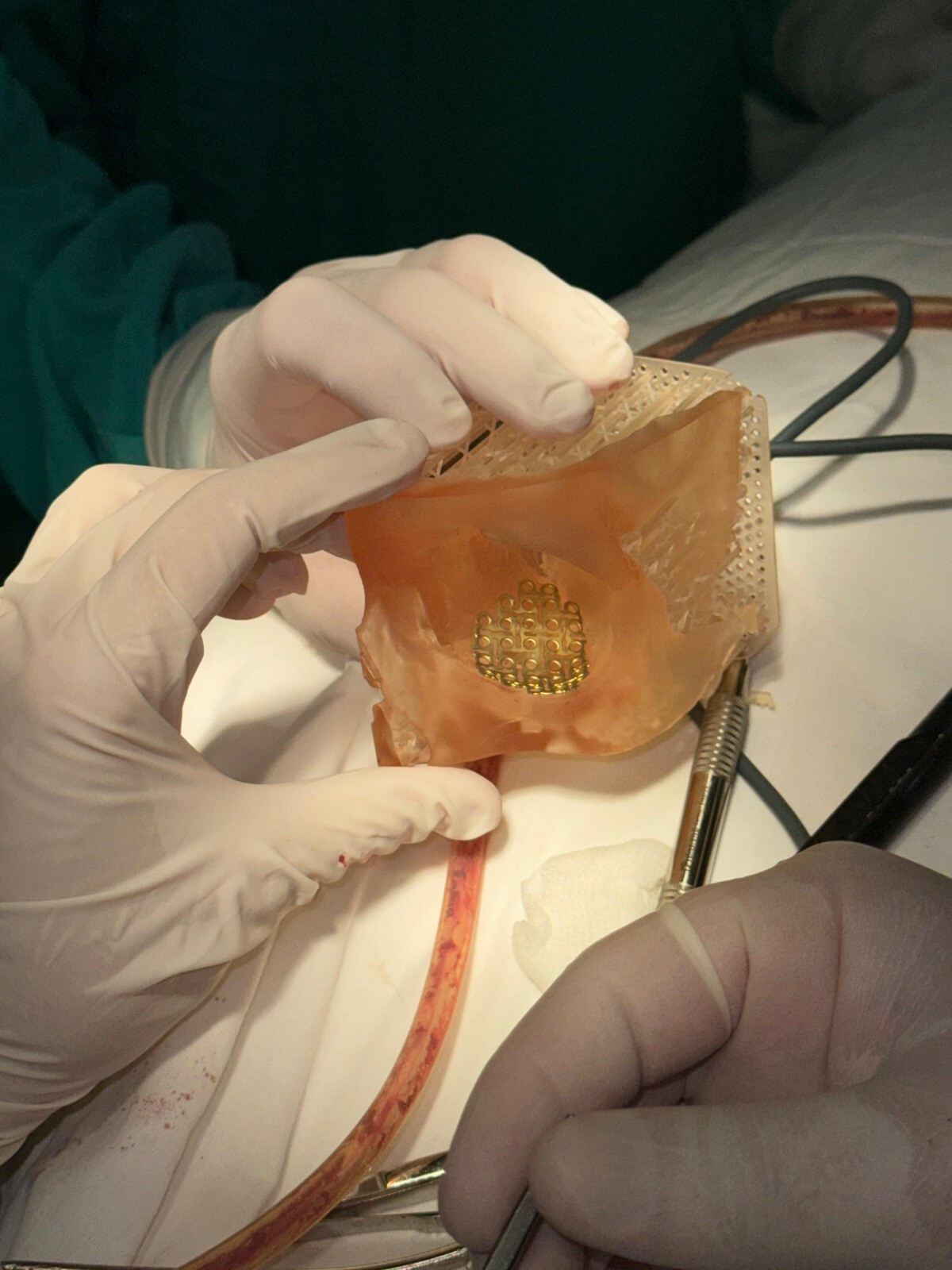 Ученые и врачи из Уфы помогли бойцу СВО восстановиться после боевой травмы