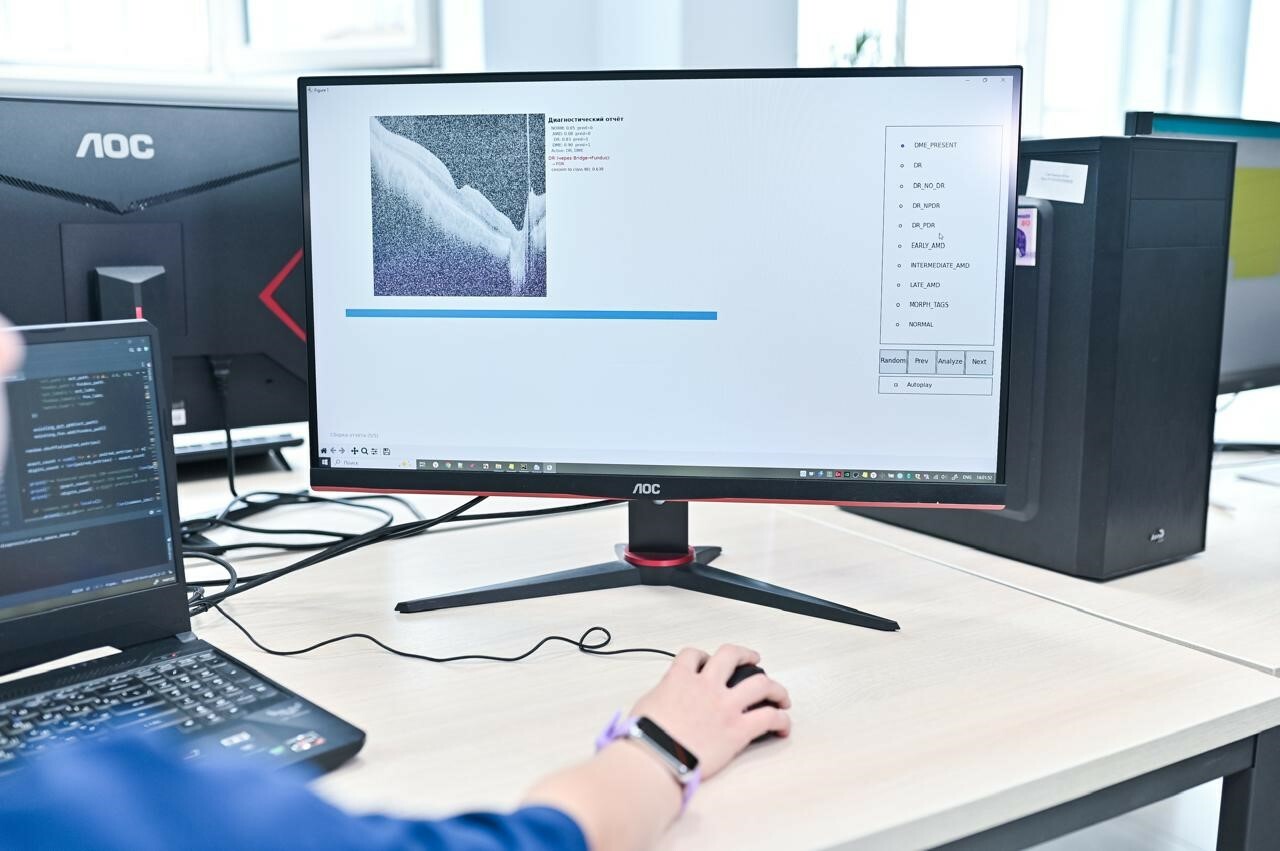 Разработка ученых поможет предотвратить потерю зрения у пожилых людей